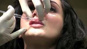 numbing cream for lip injections